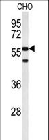 ACTR5 / ARP5 Antibody - Western blot of ACTR5 Antibody in CHO cell line lysates (35 ug/lane). ACTR5 (arrow) was detected using the purified antibody.