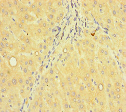 ACTR5 / ARP5 Antibody - Immunohistochemistry of paraffin-embedded human liver tissue at dilution of 1:100
