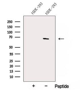 ACTR5 / ARP5 Antibody - Western blot analysis of extracts of HEK293 cells using Arp5/ACTR5 antibody. The lane on the left was treated with blocking peptide.