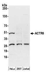 ACTR6 Antibody - Detection of human ACTR6 by western blot. Samples: Whole cell lysate (50 µg) from HeLa, HEK293T, and Jurkat cells prepared using NETN lysis buffer. Antibody: Affinity purified rabbit anti-ACTR6 antibody used for WB at 0.1 µg/ml. Detection: Chemiluminescence with an exposure time of 30 seconds.