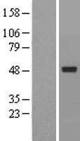 ACTR6 Protein - Western validation with an anti-DDK antibody * L: Control HEK293 lysate R: Over-expression lysate