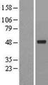 ACTR6 Protein - Western validation with an anti-DDK antibody * L: Control HEK293 lysate R: Over-expression lysate