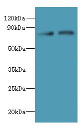 ACTR8 Antibody - Western blot. All lanes: ACTR8 antibody at 16 ug/ml. Lane 1: A549 whole cell lysate. Lane 2: HCT116 whole cell lysate. Secondary Goat polyclonal to Rabbit IgG at 1:10000 dilution. Predicted band size: 70 kDa. Observed band size: 70 kDa.