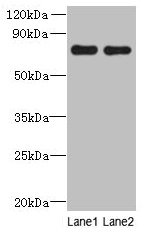 ACTR8 Antibody - Western blot All lanes: ACTR8 antibody at 16µg/ml Lane 1: A549 whole cell lysate Lane 2: HCT116 whole cell lysate Secondary Goat polyclonal to rabbit IgG at 1/10000 dilution Predicted band size: 71, 59, 37 kDa Observed band size: 71 kDa