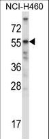 ACTRIIB / ACVR2B Antibody - Mouse Acvr2b Antibody western blot of NCI-H460 cell line lysates (35 ug/lane). The Acvr2b antibody detected the Acvr2b protein (arrow).