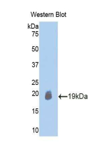 ACTRIIB / ACVR2B Antibody - Western blot of recombinant ACTRIIB / ACVR2B.  This image was taken for the unconjugated form of this product. Other forms have not been tested.