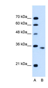 ACTRIIB / ACVR2B Antibody - ACVR2B antibody ARP45043_P050-AAH96245-ACVR2B(activin A receptor, type IIB) Antibody Western blot of HepG2 cell lysate.  This image was taken for the unconjugated form of this product. Other forms have not been tested.