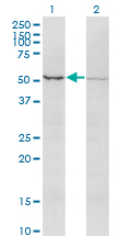 ACTRIIB / ACVR2B Antibody - Western Blot analysis of ACVR2B expression in transfected 293T cell line by ACVR2B monoclonal antibody (M03), clone 1C11.Lane 1: ACVR2B transfected lysate (Predicted MW: 34.2 KDa).Lane 2: Non-transfected lysate.