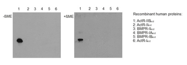 ACTRIIB / ACVR2B Antibody - Western blot with extracellular domains (ecd) of different related human receptors (50ng per lane) reveals that anti-Activin Receptor IIB, pAb (IG-510) (dilution 1:5000) specifically recoginzes ACTR-IIB under non reducing (-[Character df]ME, left panel) and reducing (+[Character df]ME; right panel) conditions, but none of the other receptor types tested.