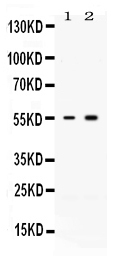 ACTRIIB / ACVR2B Antibody - Western blot analysis of ACVR2B expression in rat skeletal muscle extract (lane 1) and MCF-7 whole cell lysates (lane 2). ACVR2B at 55KD was detected using rabbit anti-ACVR2B Antigen Affinity purified polyclonal antibody at 0.5 ug/ml. The blot was developed using chemiluminescence (ECL) method.