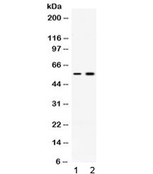 ACTRIIB / ACVR2B Antibody - Western blot testing of 1) rat skeletal muscle and 2) human MCF7 lysate with ACVR2B antibody at 0.5ug/ml. Expected molecular weight ~57 kDa.