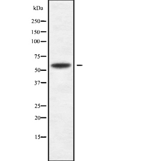 ACTRIIB / ACVR2B Antibody - Western blot analysis of ACVR2B using K562 whole cells lysates