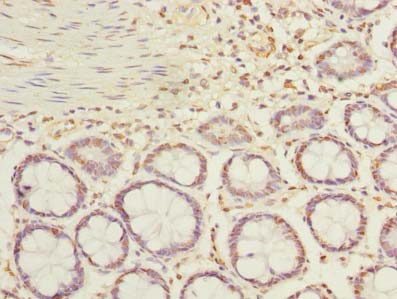 ACTRT1 Antibody - Immunohistochemistry of paraffin-embedded human rectum tissue using antibody at dilution of 1:100.