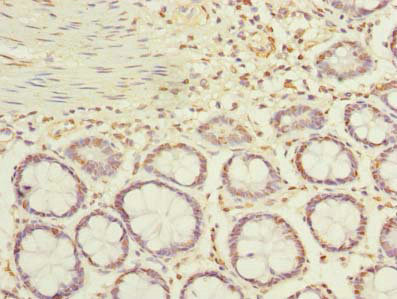 ACTRT1 Antibody - Immunohistochemistry of paraffin-embedded human rectum tissue using ACTRT1 Antibody at dilution of 1:100