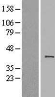 ACTRT1 Protein - Western validation with an anti-DDK antibody * L: Control HEK293 lysate R: Over-expression lysate