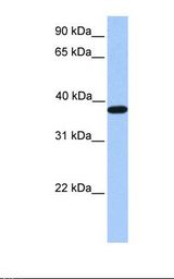 ACTRT2 Antibody - Fetal muscle lysate. Antibody concentration: 1.0 ug/ml. Gel concentration: 12%.  This image was taken for the unconjugated form of this product. Other forms have not been tested.