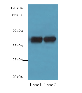 ACTRT2 Antibody - Western blot. All lanes: ACTRT2 antibody at 6 ug/ml. Lane 1: HepG-2 whole cell lysate. Lane 2: A431 whole cell lysate. Secondary Goat polyclonal to Rabbit IgG at 1:10000 dilution. Predicted band size: 42 kDa. Observed band size: 42 kDa.