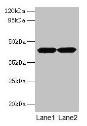 ACTRT2 Antibody - Western blot All lanes: ACTRT2 antibody at 6µg/ml Lane 1: HepG2 whole cell lysate Lane 2: A431 whole cell lysate Secondary Goat polyclonal to rabbit IgG at 1/10000 dilution Predicted band size: 42 kDa Observed band size: 42 kDa
