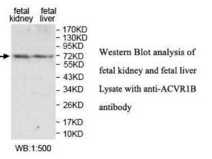 ACVR1B / ALK4 Antibody - Western blot of ACVR1B / ALK4 antibody