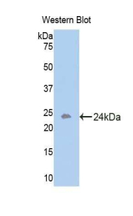 ACVR1B / ALK4 Antibody - Western blot of recombinant ACVR1B / ALK4.  This image was taken for the unconjugated form of this product. Other forms have not been tested.