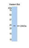 ACVR1B / ALK4 Antibody - Western blot of recombinant ACVR1B / ALK4.  This image was taken for the unconjugated form of this product. Other forms have not been tested.
