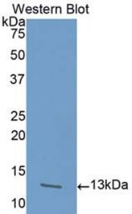 ACVR1B / ALK4 Antibody - Western blot of recombinant ACVR1B / ALK4.  This image was taken for the unconjugated form of this product. Other forms have not been tested.