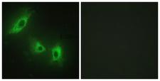 ACVR1B / ALK4 Antibody - Immunofluorescence analysis of HeLa cells, using ACV1B Antibody. The picture on the right is blocked with the synthesized peptide.