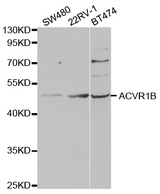 ACVR1B / ALK4 Antibody - Western blot analysis of extracts of various cell lines.