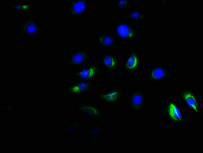 ACVR1B / ALK4 Antibody - Immunofluorescence staining of A549 cells with ACVR1B Antibody at 1:166, counter-stained with DAPI. The cells were fixed in 4% formaldehyde, permeabilized using 0.2% Triton X-100 and blocked in 10% normal Goat Serum. The cells were then incubated with the antibody overnight at 4°C. The secondary antibody was Alexa Fluor 488-congugated AffiniPure Goat Anti-Rabbit IgG(H+L).