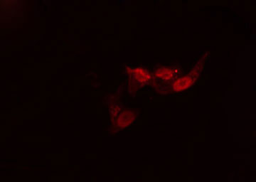 ACVR1B / ALK4 Antibody - Staining MCF-7 cells by IF/ICC. The samples were fixed with PFA and permeabilized in 0.1% Triton X-100, then blocked in 10% serum for 45 min at 25°C. The primary antibody was diluted at 1:200 and incubated with the sample for 1 hour at 37°C. An Alexa Fluor 594 conjugated goat anti-rabbit IgG (H+L) antibody, diluted at 1/600, was used as secondary antibody.