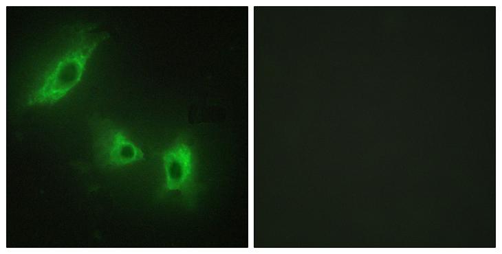 ACVR1B / ALK4 Antibody - Peptide - + Immunofluorescence analysis of HeLa cells, using ACV1B antibody.