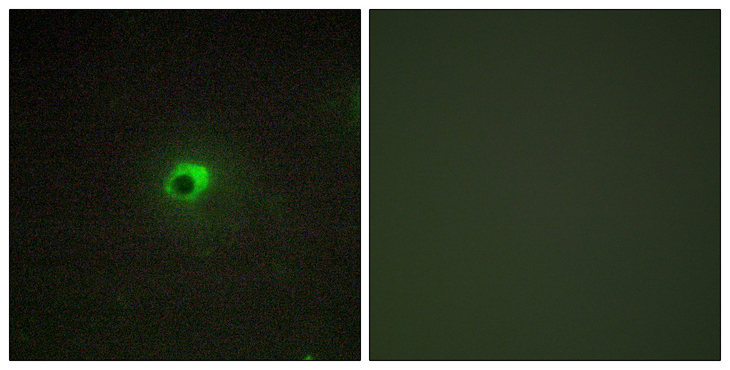 ACVR1C / ALK7 Antibody - Immunofluorescence analysis of COS7 cells, using ACTR-1C Antibody. The picture on the right is blocked with the synthesized peptide.