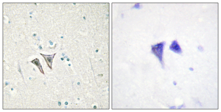 ACVR1C / ALK7 Antibody - Immunohistochemistry analysis of paraffin-embedded human brain tissue, using ACTR-1C Antibody. The picture on the right is blocked with the synthesized peptide.