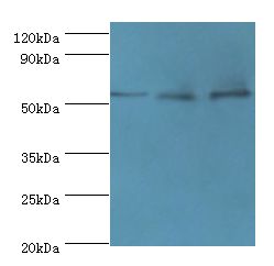 ACVR1C / ALK7 Antibody - Western blot. All lanes: ACVR1C antibody at 4 ug/ml. Lane 1: mouse brain tissue. Lane 2: HepG2 whole cell lysate. Lane 3: HeLa whole cell lysate. Secondary antibody: Goat polyclonal to rabbit at 1:10000 dilution. Predicted band size: 55 kDa. Observed band size: 55 kDa.