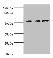 ACVR1C / ALK7 Antibody - Western blot All lanes: ACVR1C antibody at 4µg/ml Lane 1: Mouse brain tissue Lane 2: HepG2 whole cell lysate Lane 3: Hela whole cell lysate Secondary Goat polyclonal to rabbit IgG at 1/10000 dilution Predicted band size: 55, 38, 47, 50 kDa Observed band size: 55 kDa
