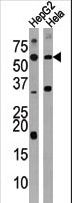 ACVR1C / ALK7 Antibody - Western blot of anti-ACVR1C Antibody (N-term A48) in HepG2 and HeLa cell line lysate (35 ug/lane). ACVR1C (arrow) was detected using the purified antibody.