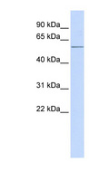 ACVR1C / ALK7 Antibody - ACVR1C antibody Western blot of Fetal Brain lysate. This image was taken for the unconjugated form of this product. Other forms have not been tested.