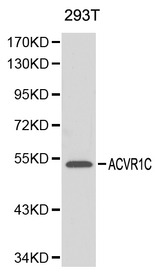 ACVR1C / ALK7 Antibody - Western blot of ACVR1C pAb in extracts from 293T cells.