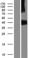 ACVR1C / ALK7 Protein - Western validation with an anti-DDK antibody * L: Control HEK293 lysate R: Over-expression lysate