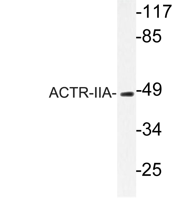 ACVR2 / ACVR2A Antibody - Western blot analysis of lysates from rat kidney, using ACTR-IIA antibody.