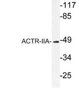 ACVR2 / ACVR2A Antibody - Western blot analysis of lysates from rat kidney, using ACTR-IIA antibody.