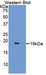 ACVR2 / ACVR2A Antibody - Western blot of recombinant ACVR2 / ACVR2A.  This image was taken for the unconjugated form of this product. Other forms have not been tested.