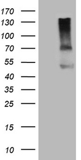 ACVR2 / ACVR2A Antibody - HEK293T cells were transfected with the pCMV6-ENTRY control. (Left lane) or pCMV6-ENTRY ACVR2A. (Right lane) cDNA for 48 hrs and lysed. Equivalent amounts of cell lysates. (5 ug per lane) were separated by SDS-PAGE and immunoblotted with anti-ACVR2A. (1:500)