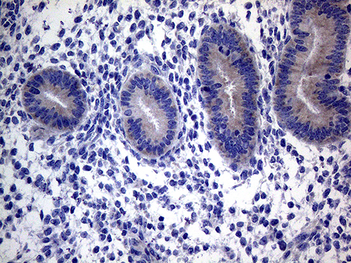 ACVR2 / ACVR2A Antibody - Immunohistochemical staining of paraffin-embedded Human endometrium tissue within the normal limits using anti-ACVR2A mouse monoclonal antibody. (Heat-induced epitope retrieval by 1mM EDTA in 10mM Tris buffer. (pH8.5) at 120°C for 3 min. (1:2000)