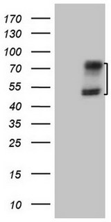 ACVR2 / ACVR2A Antibody - HEK293T cells were transfected with the pCMV6-ENTRY control. (Left lane) or pCMV6-ENTRY ACVR2A. (Right lane) cDNA for 48 hrs and lysed. Equivalent amounts of cell lysates. (5 ug per lane) were separated by SDS-PAGE and immunoblotted with anti-ACVR2A.