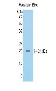 ACVR2 / ACVR2A Antibody - Western blot of recombinant ACVR2 / ACVR2A.  This image was taken for the unconjugated form of this product. Other forms have not been tested.