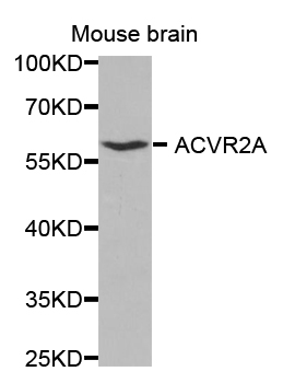 ACVR2 / ACVR2A Antibody - Western blot analysis of extracts of mouse brain, using ACVR2A antibody.