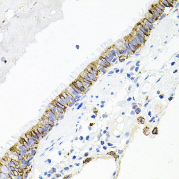 ACVR2 / ACVR2A Antibody - Immunohistochemistry of paraffin-embedded human lung tissue.