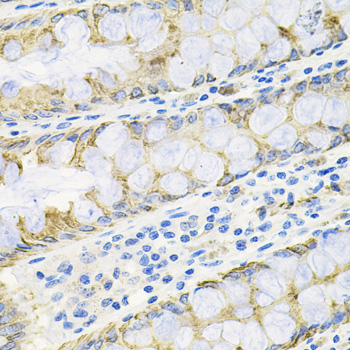 ACVR2 / ACVR2A Antibody - Immunohistochemistry of paraffin-embedded human colon tissue.