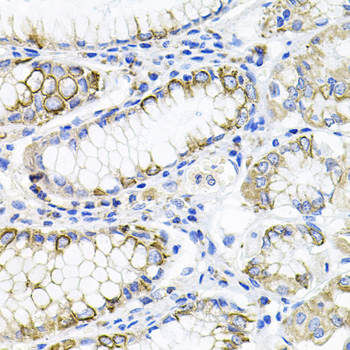 ACVR2 / ACVR2A Antibody - Immunohistochemistry of paraffin-embedded human stomach tissue.